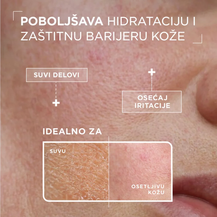 Hidratantni serum - Anti-dryness 30 ml — slika 6